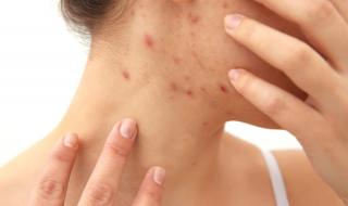 中国艾滋病分布 中国艾滋病分布