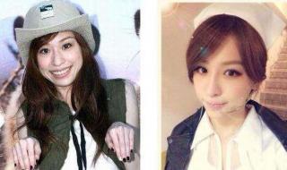 整下巴要多少钱 整下巴要多少钱